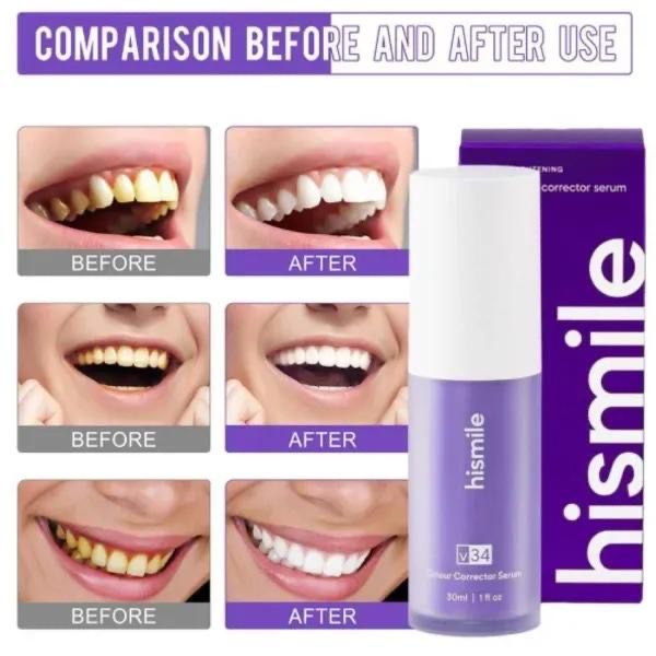 Hismile V34 Teeth Whitening Serum